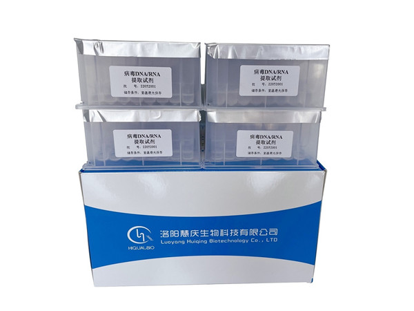 磁珠法核酸提取試劑盒的選購要求有哪些？