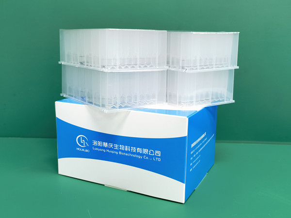 體外診斷行業(yè)的發(fā)展趨勢(shì)是什么？且看核酸提取試劑廠家解讀